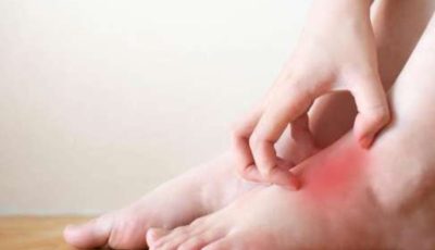 علامات تحذيرية في ساقيك قد تشير لأمراض القلب.. لا تتأخر بزيارة الطبيب!