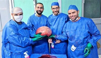 استئصال ورم ضخم أنقذ حياة فتاة بمستشفى الفيوم العام