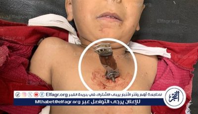 فريق طبي ينجح في إنقاذ طفل بمعجزة لتعرضه لضربة بآلة حادة بالصدر