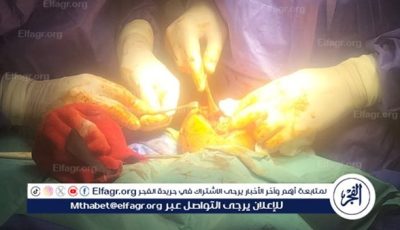 نجاح أول جراحة للمخ والأعصاب بمستشفى بلقاس