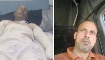 قاد سيارة مشتعلة لإنقاذ عشرات الأرواح.. مستشفى أهل مصر يستجيب لعلاج الأسطى خالد